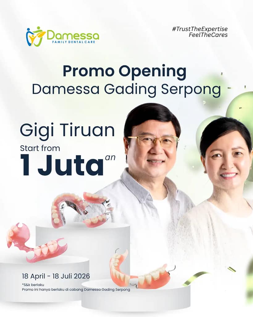 Gigi Tiruan Gigi Tiruan